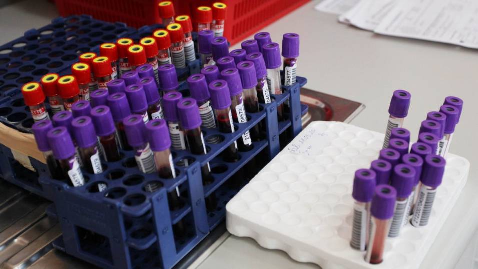 В България бяха регистрирани 523 нови случая на коронавирус, показват