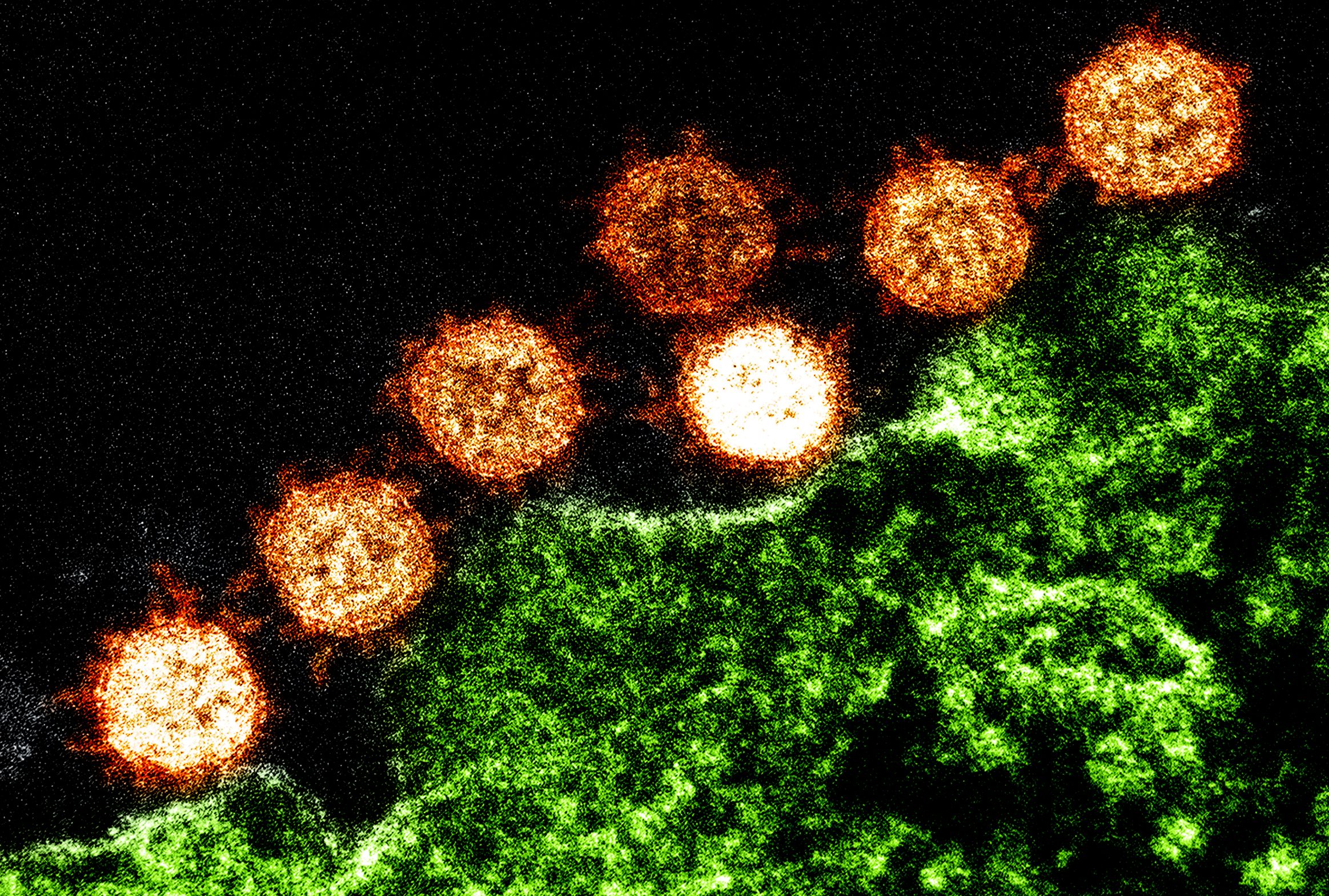 Эта игра настоящий вирус. Коронавирус в микроскопе. Вирус коронавирус. Вирус SARS-cov-2 под микроскопом. Вирус Covid 19 под микроскопом.