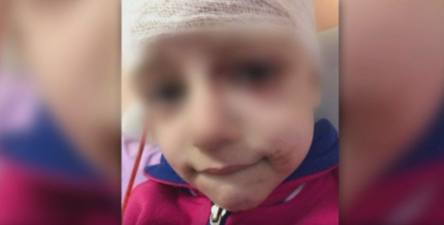 Брутално нападение на питбул над дете в София. Инцидентът е