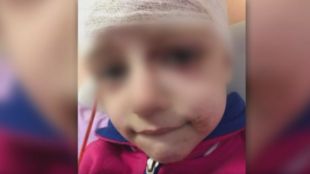 Брутално нападение на питбул над дете в София Инцидентът е