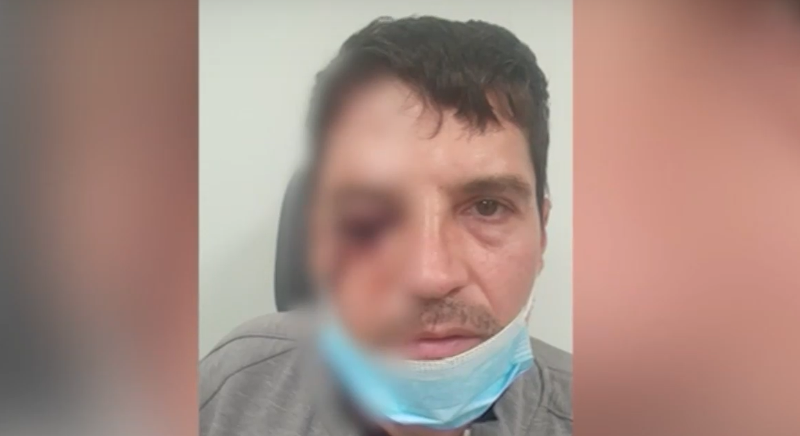 Нападение с чукове в центъра на София. 46-годишен мъж е