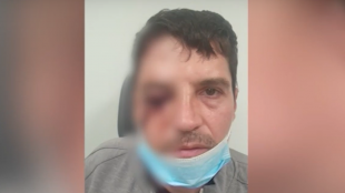 Нападение с чукове в центъра на София 46 годишен мъж е