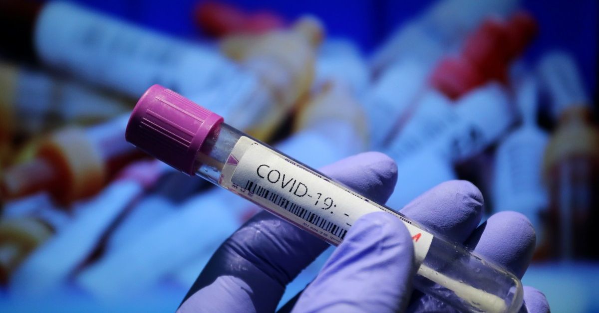 23 са потвърдените случаи на зараза с Ковид-19 в България