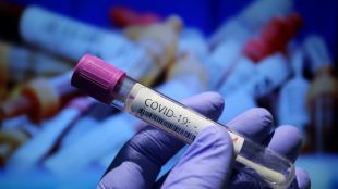 Новите случаи на коронавирус регистрирани за последното денонощие са 2018