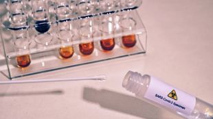 Румънски учени са създали PCR тест който установява не само