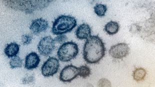 Нов вариант на коронавируса представляващ хибрид между щамовете Делта и