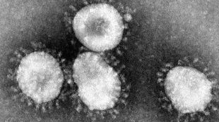 Новият подвариант на коронавируса Омикрон XBB 1 е открит в