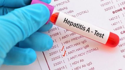 Случаите на остър хепатит с неизяснен произход при деца са