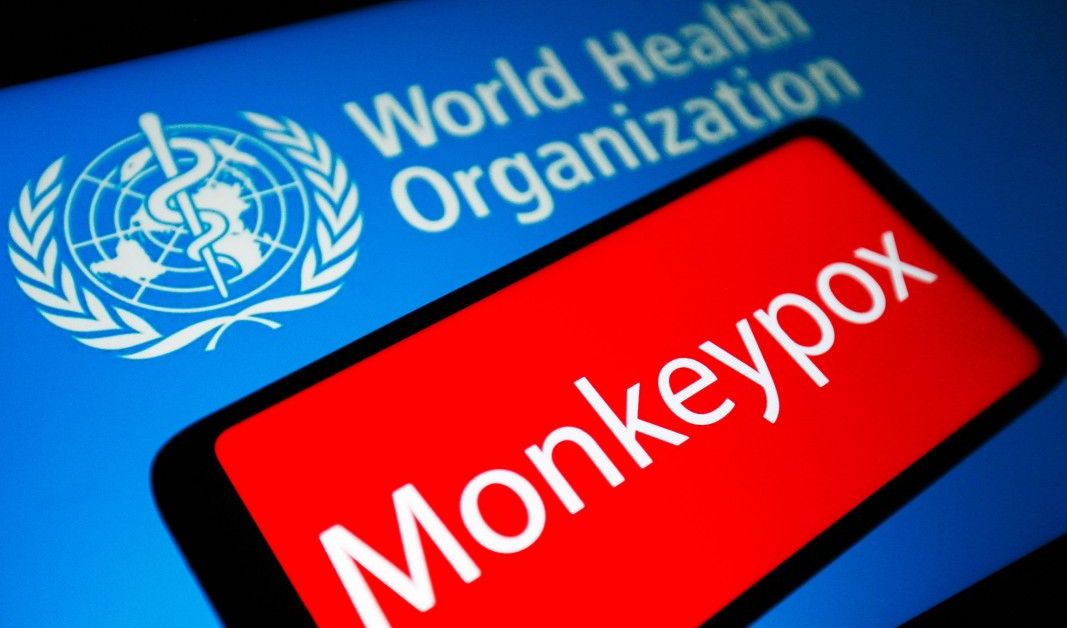 Световната здравна организация (СЗО) планира да преименува маймунската шарка на
