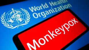 Първи починал от маймунска шарка в Съединените щати Според департамента
