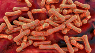 Медицинските власти в нигерийската столица Абуджа обявиха епидемия от дифтерия