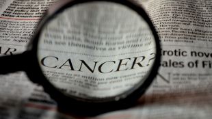 При близо 50 от болните с недребноклетъчен рак на белия