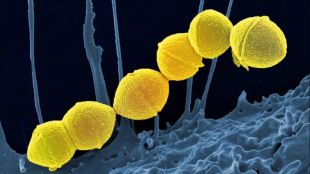 Рядка смъртоносна бактериална инфекция разяждаща плътта се разпространява с рекордна