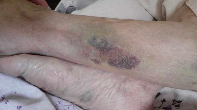 Снимка: Насилие над 104-годишна баба във Видинската болница
