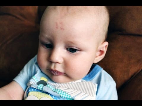 Бебе се роди с числото 12 на челото си (видео)