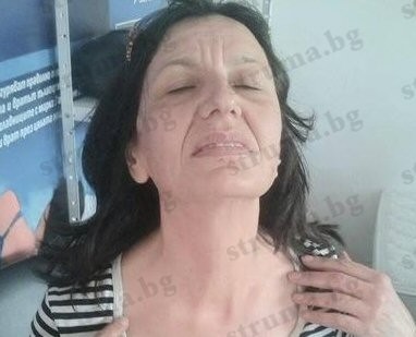 Търговка бе нападната и окървавена от бивши бизнес партньори в Сандански