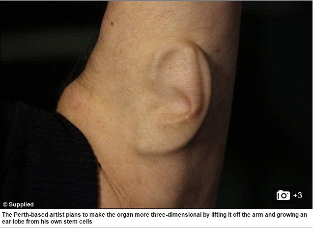 Учен иска да свърже присаденото си ухо към интернет (Снимки)