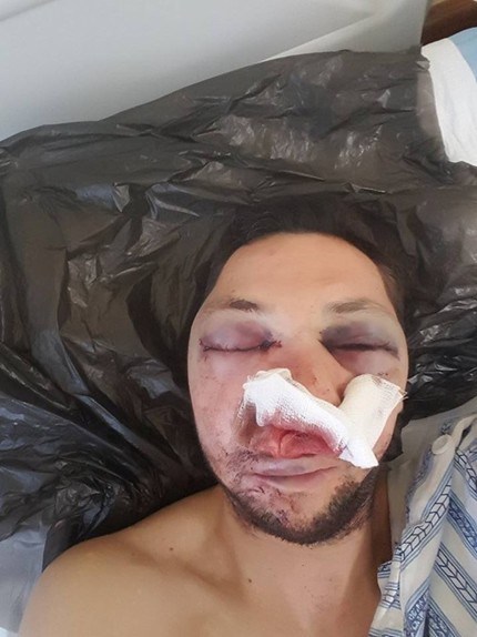 Разпитват двама за побоя над журналиста Стоян Тончев