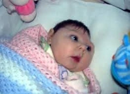 Четири случая на Зика потвърдени във Великобритания