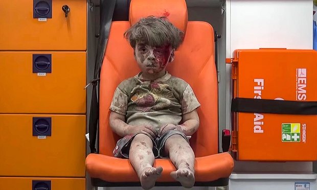 Петгодишният Омран, който показа грозното лице на войната в Сирия