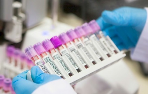 Бум на заразени с хепатит деца в старозагорско село