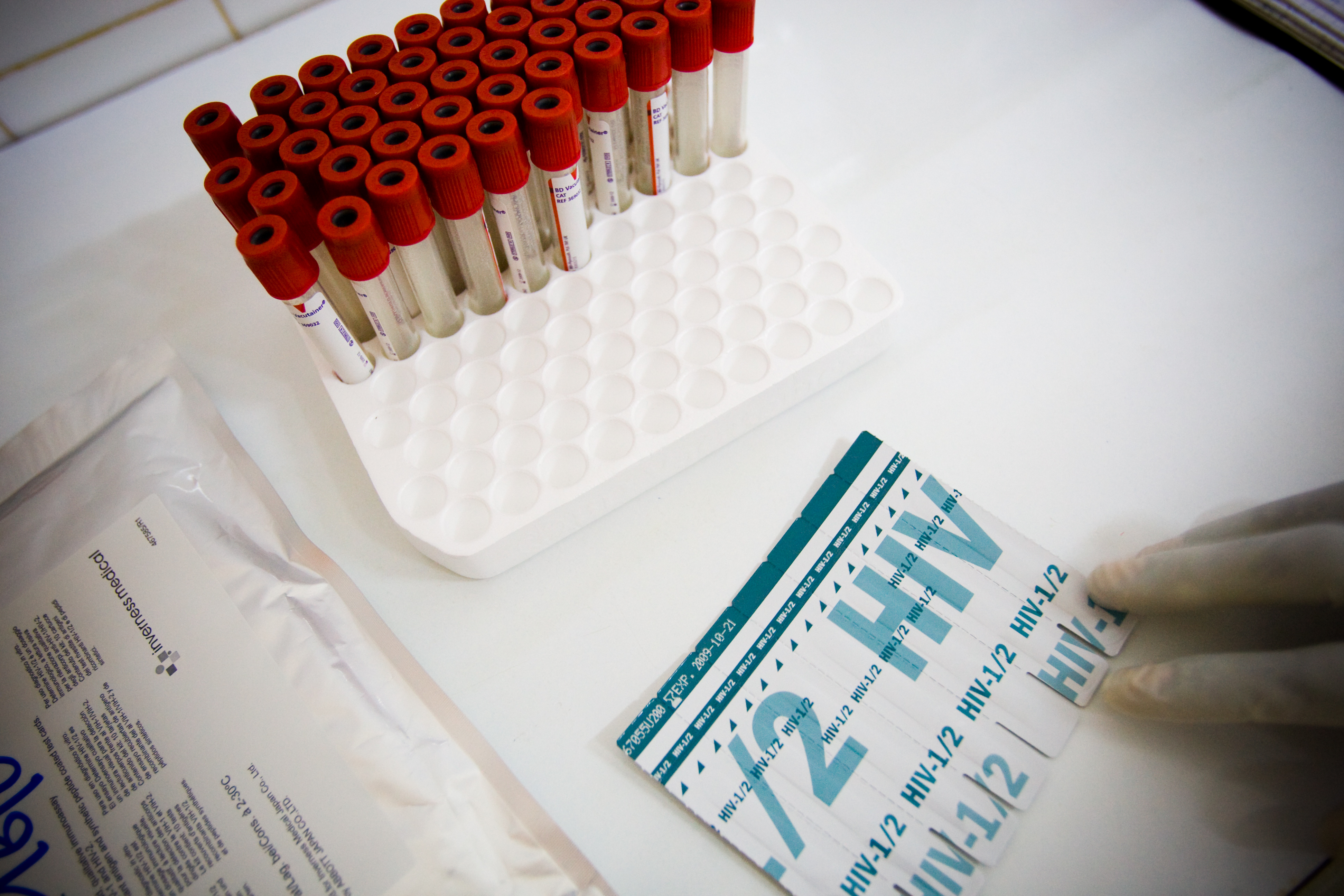 Примата на търновската оперета Лина Ковачева се нуждае от спешно кръвопреливане