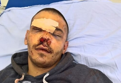 Плевенчанин зверски  пребит  заради гадже