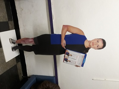 Безплатни прегледи за псориазис в Пловдив в рамките на кампанията „Какво става под кожата Ви?”