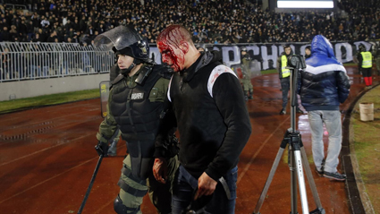 Поне 20 души пострадаха на дербито в Сърбия