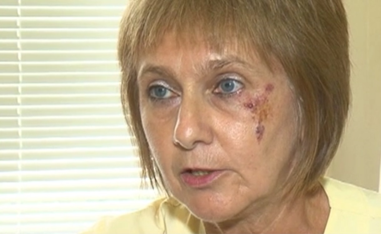 Нападнатата лекарка в Добрич: Бащата започна да заплашва, че ще ме убие