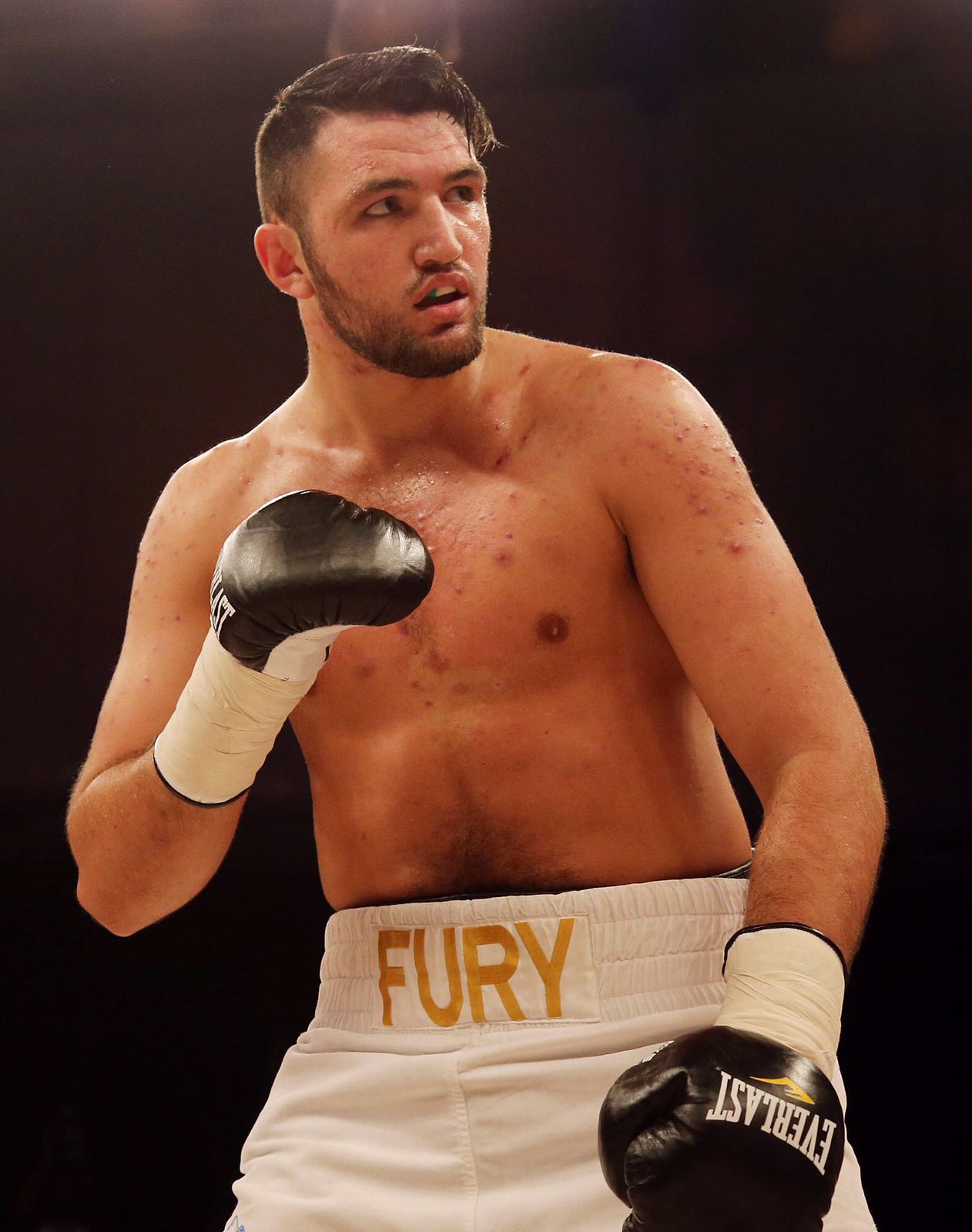 Фюри ще търси нокаут срещу Кобрата