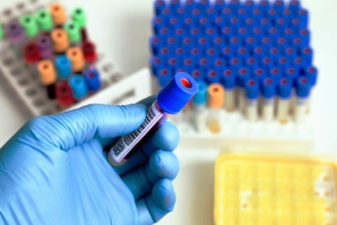 СЗО: Засега няма за бъде въвеждано международно извънредно положение заради коронавируса от Китай