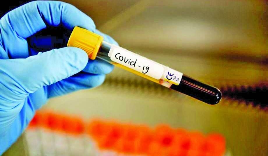 Близо 20 000 нови случая на COVID-19 в Германия, над 5 000 в Австрия
