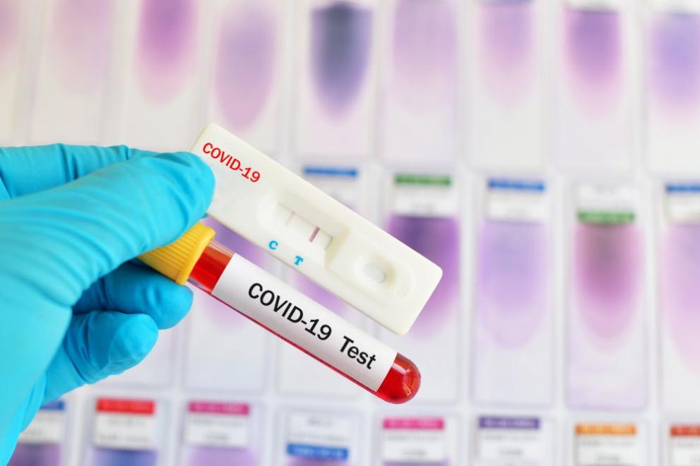 САЩ пускат първия бърз домашен тест за COVID-19