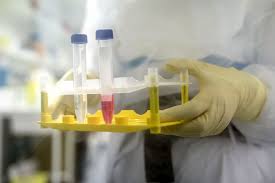 Нов печален рекорд на заразени с коронавирус в Гърция, обмислят нови мерки