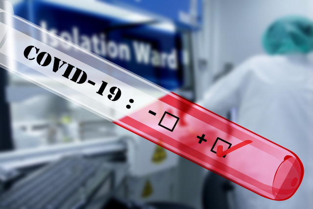 49 служители на МВР са били заразени с COVID-19