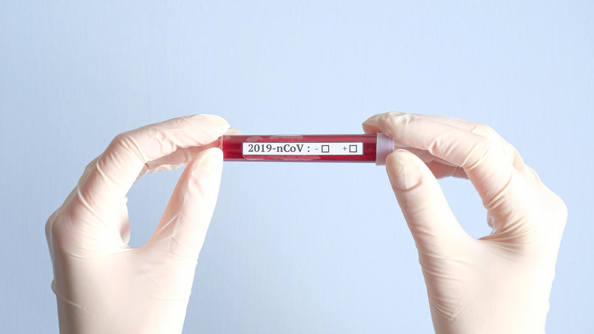 Над 30 000 са починали от COVID-19 във Великобритания