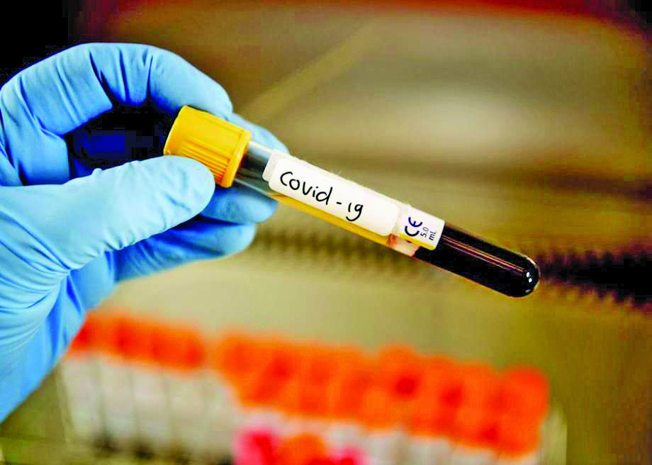 Броят на починалите за деня от COVID-19 в Испания отново надхвърли 200