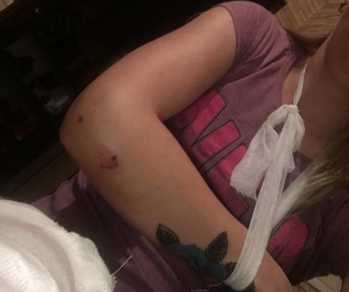 Група мъже пребиха жена, излязла да си купи цигари