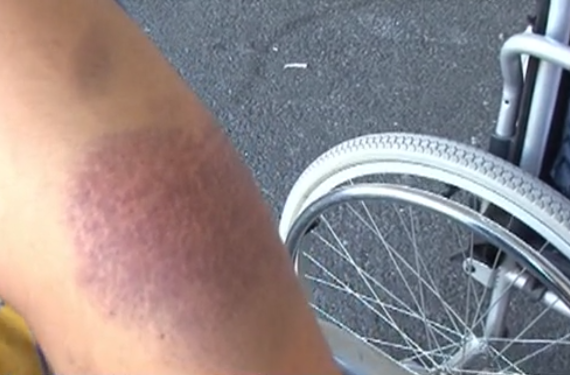 Едно от блъснатите в Китен деца: Шофьорът ни каза "добре сте, нищо ви няма, ставайте!"