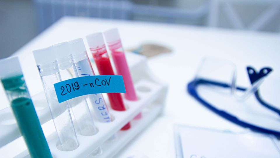 Служител на Министерството на туризма е с COVID-19