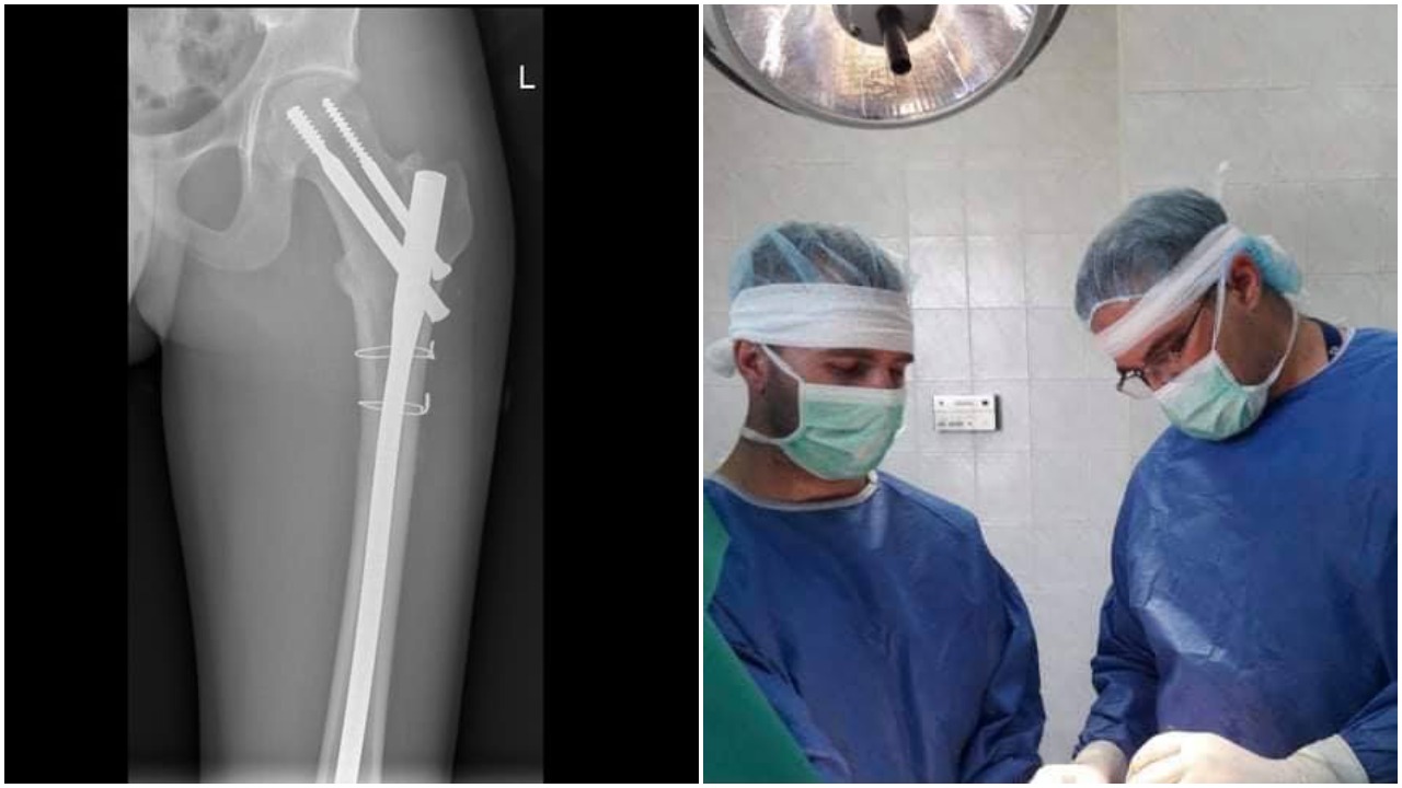 COVID-19 може да повлияе на ставите и костите