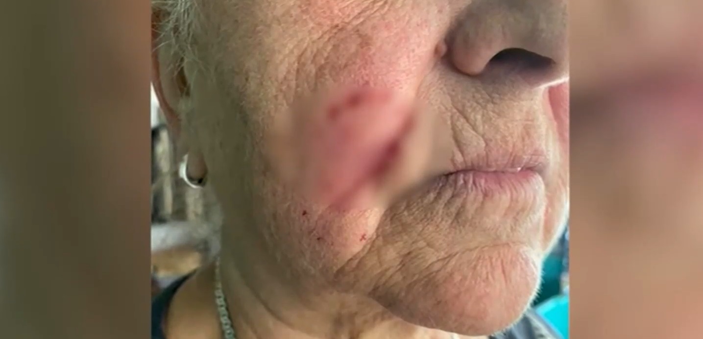 Каракачанка нападна и нахапа възрастна жена