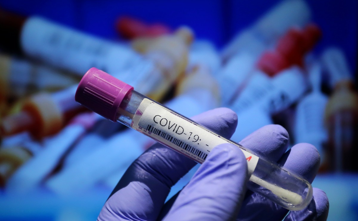 Спипаха брат и сестра от Русе с фалшиви PCR тестове на път към Румъния