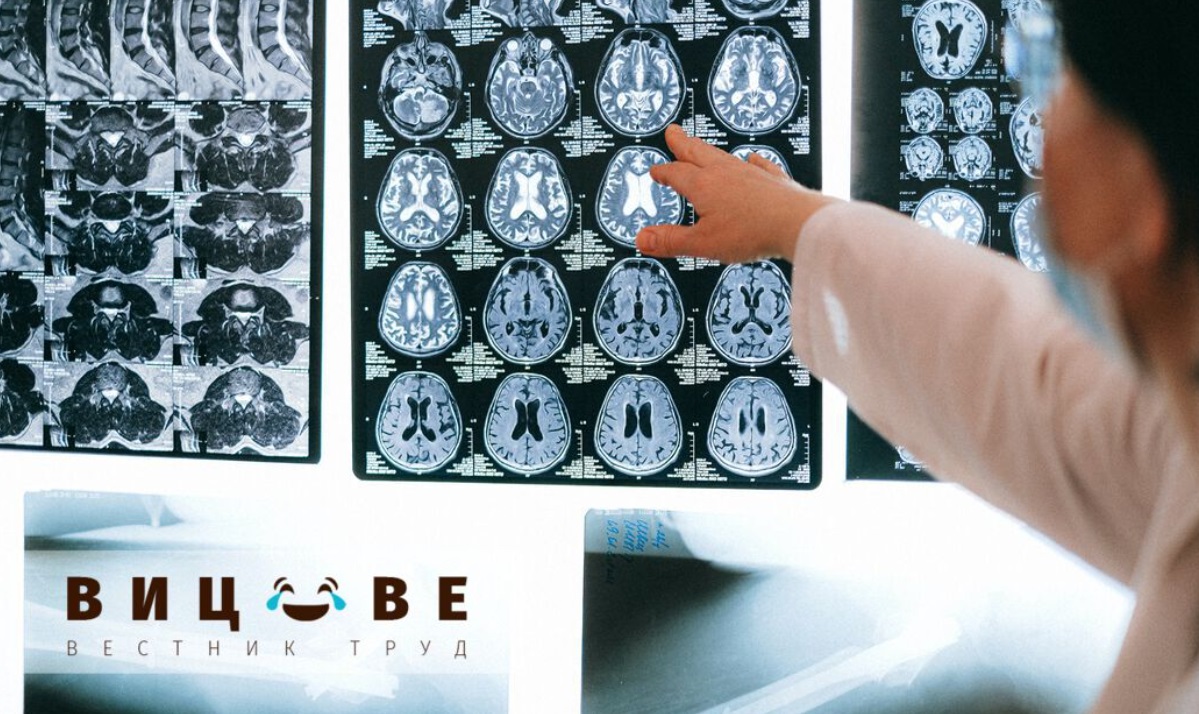 Могат ли да се правят мозъчни операции на политици? Отговорът на Радио Ереван