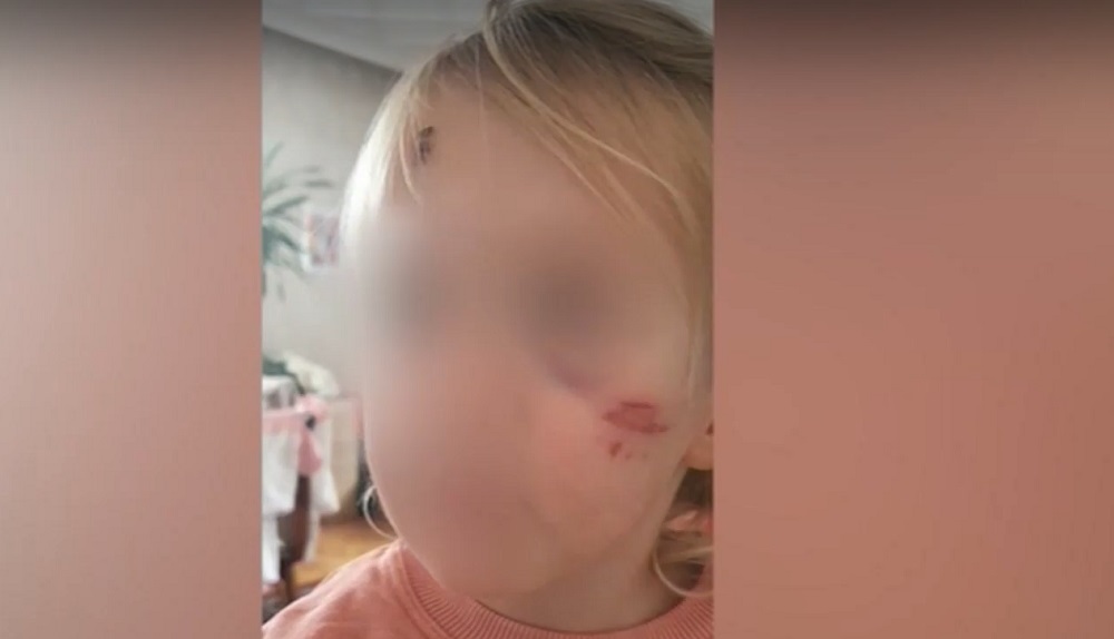 Дете е с разцепена буза след рязко спиране на таксиджия