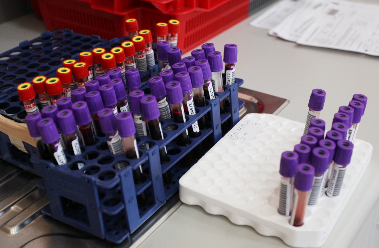 1033 нови заразени с коронавирус у нас