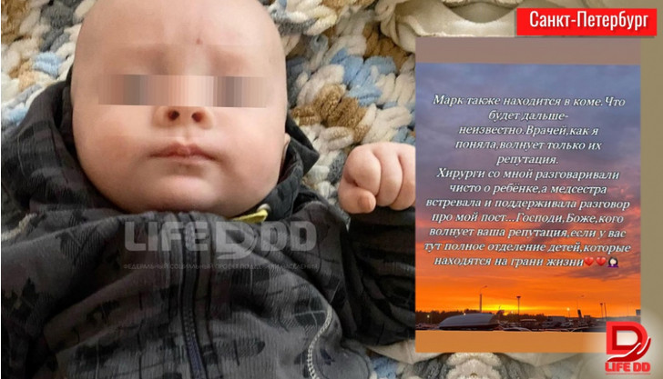 Бебе на два месеца с инсулт заради Омикрон