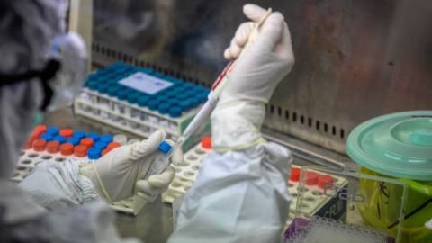 515 са новите случаи на COVID-19 у нас