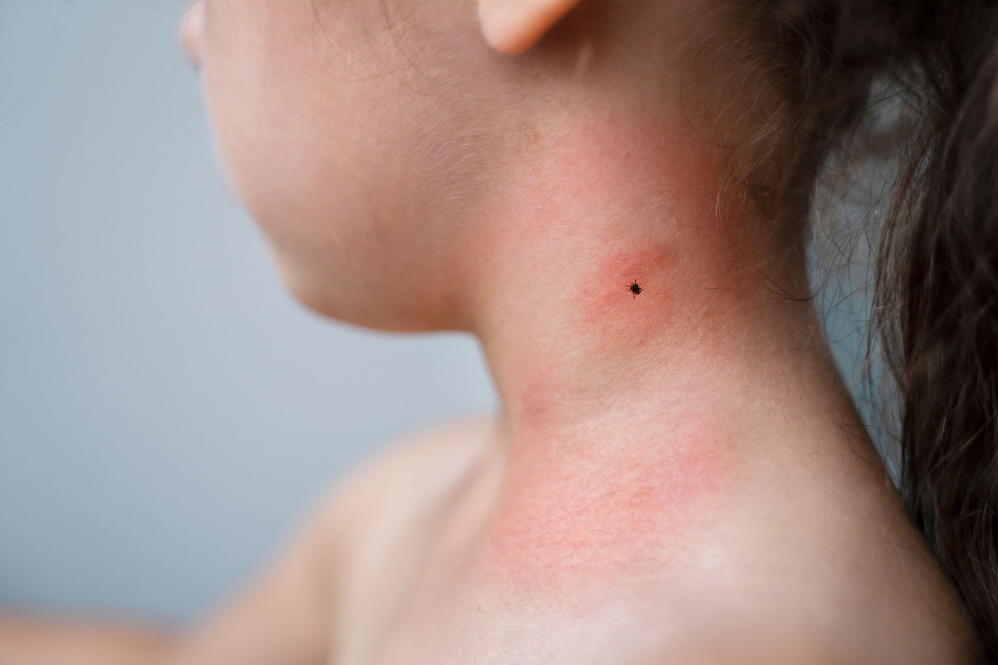 Кърлежите предпочитат млада плът